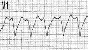 VII-10index