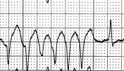 VII-13index