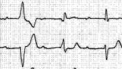 VII-15index