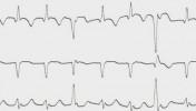 VII-19index