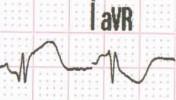 VII-8index